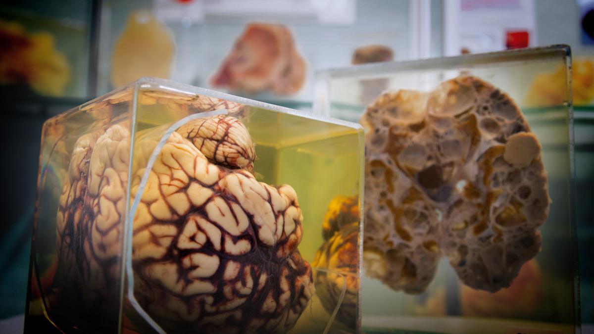 photo of brains medical specimens